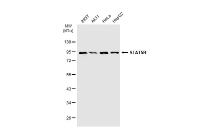 Anti-STAT5B antibody [GT1160] used in Western Blot (WB). GTX08967