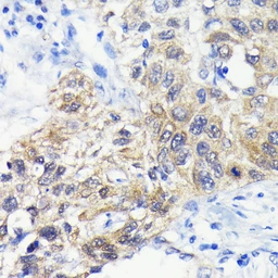 Anti-ATG3 antibody [GT1174] used in IHC (Paraffin sections) (IHC-P). GTX09507