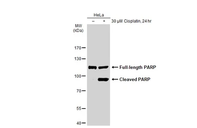 Anti-PARP antibody [GT1176] used in Western Blot (WB). GTX09509