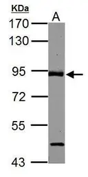 Anti-ABR antibody [C3], C-term used in Western Blot (WB). GTX100031