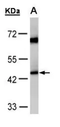 Anti-ACADM antibody used in Western Blot (WB). GTX100032