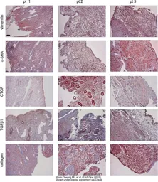 Anti-alpha Smooth Muscle Actin antibody used in IHC (Paraffin sections) (IHC-P). GTX100034