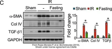 Anti-alpha Smooth Muscle Actin antibody used in Western Blot (WB). GTX100034