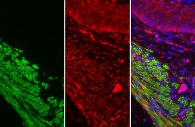 Anti-alpha Smooth Muscle Actin antibody used in IHC (Paraffin sections) (IHC-P). GTX100034