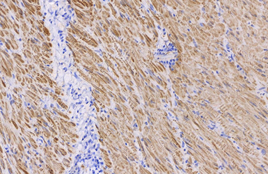 Anti-alpha Smooth Muscle Actin antibody used in IHC (Paraffin sections) (IHC-P). GTX100034