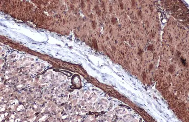 Anti-alpha Smooth Muscle Actin antibody used in IHC (Paraffin sections) (IHC-P). GTX100034