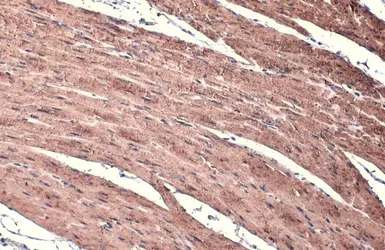 Anti-alpha Smooth Muscle Actin antibody used in IHC (Paraffin sections) (IHC-P). GTX100034