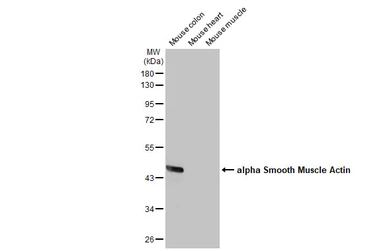 Anti-alpha Smooth Muscle Actin antibody used in Western Blot (WB). GTX100034