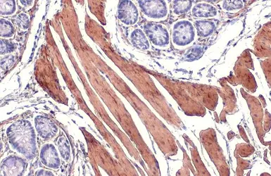 Anti-alpha Smooth Muscle Actin antibody used in IHC (Paraffin sections) (IHC-P). GTX100034