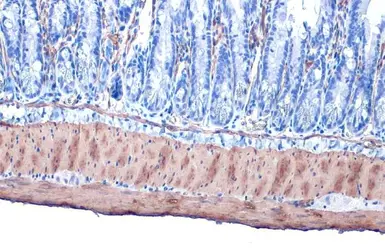 Anti-alpha Smooth Muscle Actin antibody used in IHC (Paraffin sections) (IHC-P). GTX100034