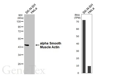 Anti-alpha Smooth Muscle Actin antibody used in Western Blot (WB). GTX100034