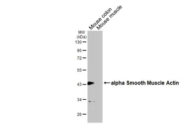 Anti-alpha Smooth Muscle Actin antibody used in Western Blot (WB). GTX100034