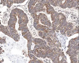 Anti-Survivin antibody used in IHC (Paraffin sections) (IHC-P). GTX100052