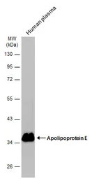 Anti-Apolipoprotein E antibody [C2C3], C-term used in Western Blot (WB). GTX100053
