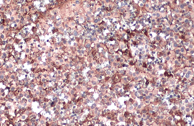 Anti-Apolipoprotein E antibody [C2C3], C-term used in IHC (Paraffin sections) (IHC-P). GTX100053