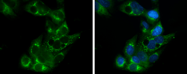 Anti-Apolipoprotein E antibody [C2C3], C-term used in Immunocytochemistry/ Immunofluorescence (ICC/IF). GTX100053