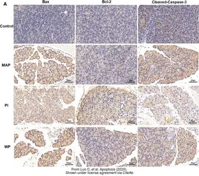Anti-Bcl-2 antibody [N1N2], N-term used in IHC (Paraffin sections) (IHC-P). GTX100064