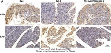 Anti-Bcl-2 antibody [N1N2], N-term used in IHC (Paraffin sections) (IHC-P). GTX100064