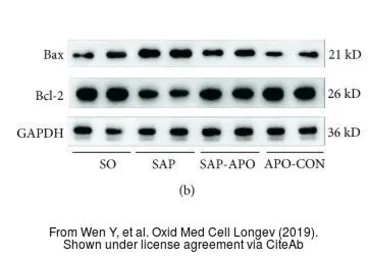 Anti-Bcl-2 antibody [N1N2], N-term used in Western Blot (WB). GTX100064