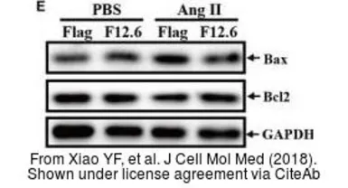 Anti-Bcl-2 antibody [N1N2], N-term used in Western Blot (WB). GTX100064
