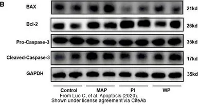 Anti-Bcl-2 antibody [N1N2], N-term used in Western Blot (WB). GTX100064