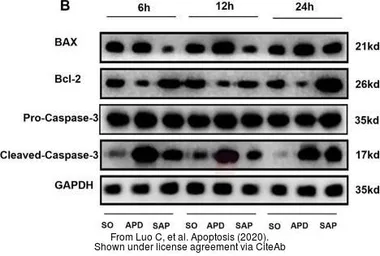 Anti-Bcl-2 antibody [N1N2], N-term used in Western Blot (WB). GTX100064
