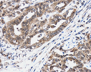 Anti-Bcl-2 antibody [N1N2], N-term used in IHC (Paraffin sections) (IHC-P). GTX100064