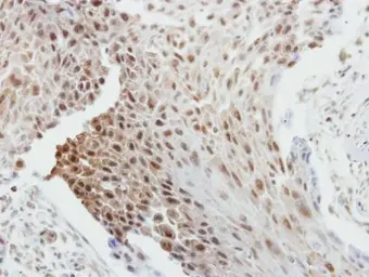 Anti-Bcl-2 antibody [N1N2], N-term used in IHC (Paraffin sections) (IHC-P). GTX100064