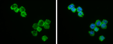 Anti-Bcl-2 antibody [N1N2], N-term used in Immunocytochemistry/ Immunofluorescence (ICC/IF). GTX100064