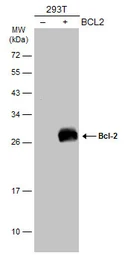 Anti-Bcl-2 antibody [N1N2], N-term used in Western Blot (WB). GTX100064