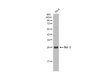 Anti-Bcl-2 antibody [N1N2], N-term used in Western Blot (WB). GTX100064