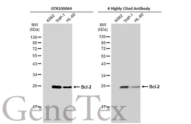 Anti-Bcl-2 antibody [N1N2], N-term used in Western Blot (WB). GTX100064