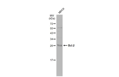 Anti-Bcl-2 antibody [N1N2], N-term used in Western Blot (WB). GTX100064
