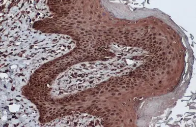 Anti-Bcl-2 antibody [N1N2], N-term used in IHC (Paraffin sections) (IHC-P). GTX100064