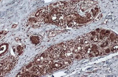 Anti-Bcl-2 antibody [N1N2], N-term used in IHC (Paraffin sections) (IHC-P). GTX100064