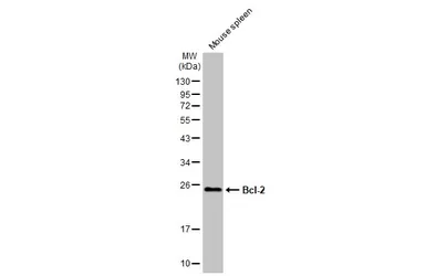 Anti-Bcl-2 antibody [N1N2], N-term used in Western Blot (WB). GTX100064