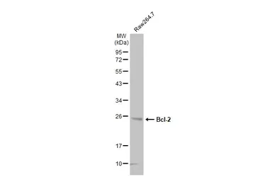 Anti-Bcl-2 antibody [N1N2], N-term used in Western Blot (WB). GTX100064