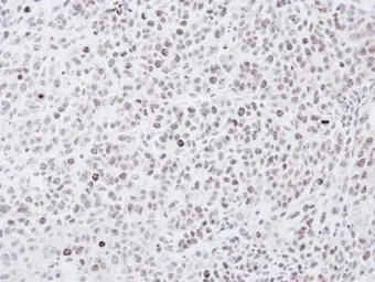 Anti-Chk1 antibody [C1C2-6], Internal used in IHC (Paraffin sections) (IHC-P). GTX100070