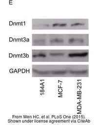 Anti-GAPDH antibody used in Western Blot (WB). GTX100118