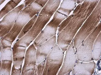 Anti-TIP30 antibody used in IHC (Paraffin sections) (IHC-P). GTX100119