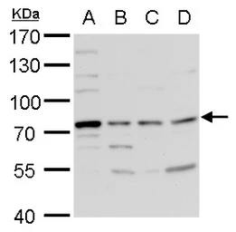 Anti-TDP1 antibody [N1N3] used in Western Blot (WB). GTX100126
