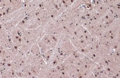 Anti-DDB1 antibody used in IHC (Paraffin sections) (IHC-P). GTX100130