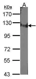 Anti-DDB1 antibody used in Western Blot (WB). GTX100130