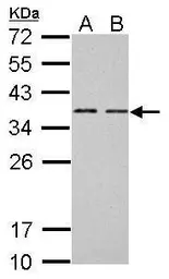 Anti-BCL7A antibody [C2C3], C-term used in Western Blot (WB). GTX100197