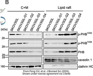 Anti-Caveolin 1 antibody [N1N3] used in Western Blot (WB). GTX100205