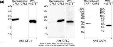 Anti-Cofilin 2 antibody used in Western Blot (WB). GTX100213