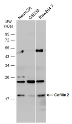 Anti-Cofilin 2 antibody used in Western Blot (WB). GTX100213