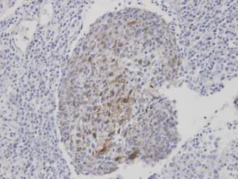 Anti-CLCA1 antibody [C1C2], Internal used in IHC (Paraffin sections) (IHC-P). GTX100217