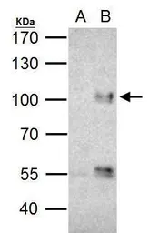 Anti-FOXO3A antibody [C3], C-term used in Immunoprecipitation (IP). GTX100277