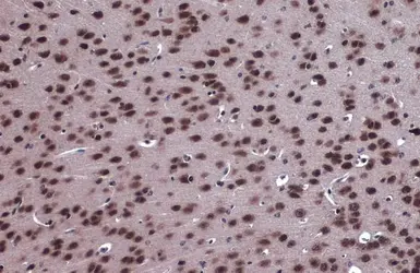 Anti-FOXO3A antibody [C3], C-term used in IHC (Paraffin sections) (IHC-P). GTX100277